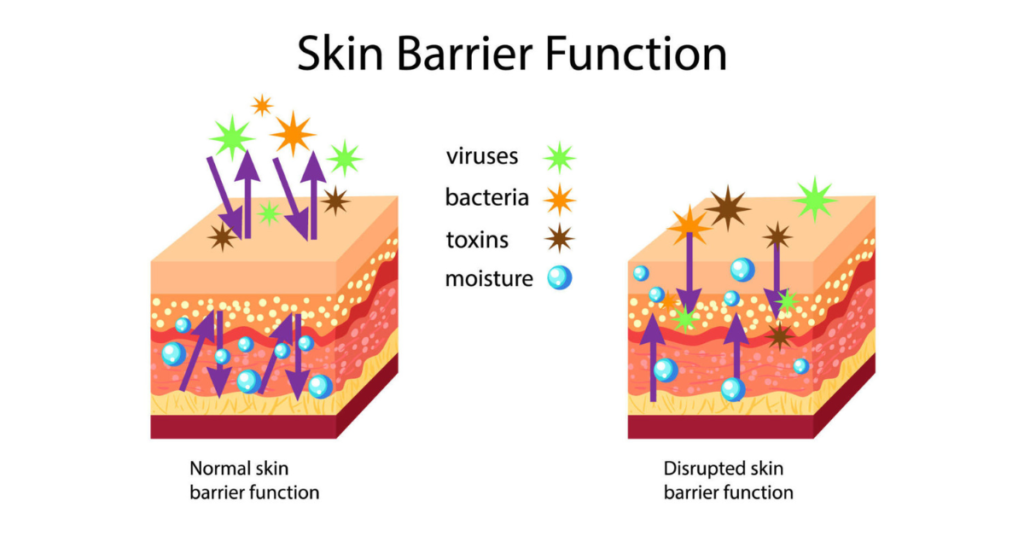 Skin Barrier Diagram